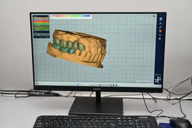 MKÜ Diş Hastanesinde 3D Yazıcılarla Zirkonya Protez Üretimi